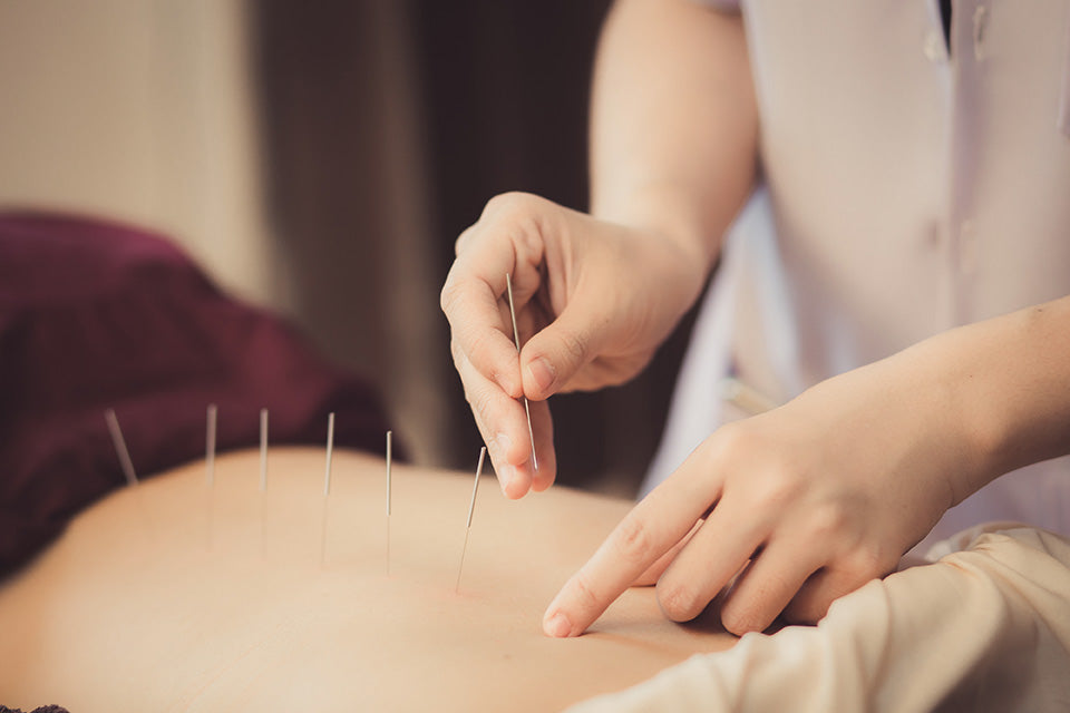 Acupuncture : de l’origine à la science