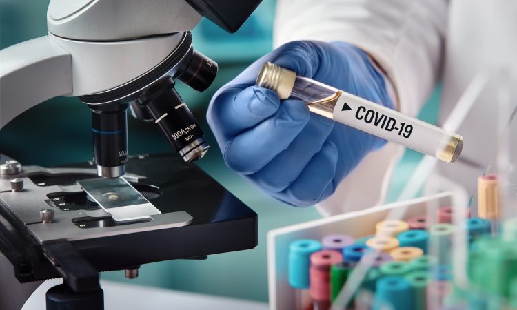 scientifique tenant éprouvette contenant le virus Covid-19