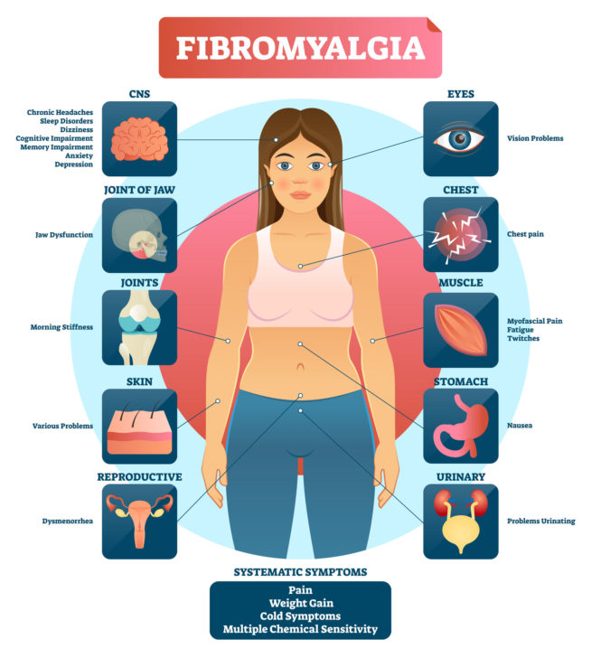 version anglophone du graphique des symptômes de la fibromyalgie