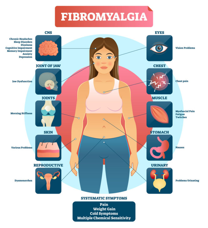 A Treatment for Fibromyalgia!? Vitoli